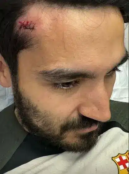 نقل نجم برشلونة إيلكاي غاندوغان إلى المستشفى 2 إيلكاي غاندوغان