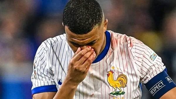 ريال مدريد يتابع بقلق إصابة مبابي مع منتخب فرنسا 1 ريال مدريد يتابع