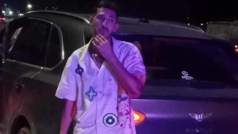 حادث أحمد فتوح لاعب الزمالك.. ماذا حدث من يوم واقعة الدهس حتى الآن؟ (صور) 1 حادث أحمد فتوح لاعب الزمالك.. ماذا حدث من يوم واقعة الدهس حتى الآن؟ (صور)